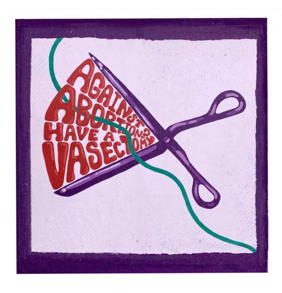Vasectomy